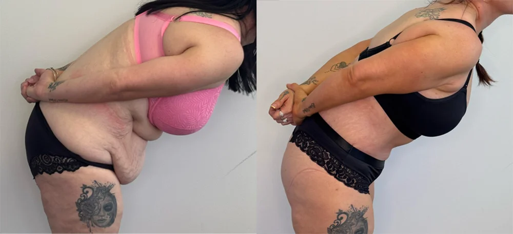 ab 1-4