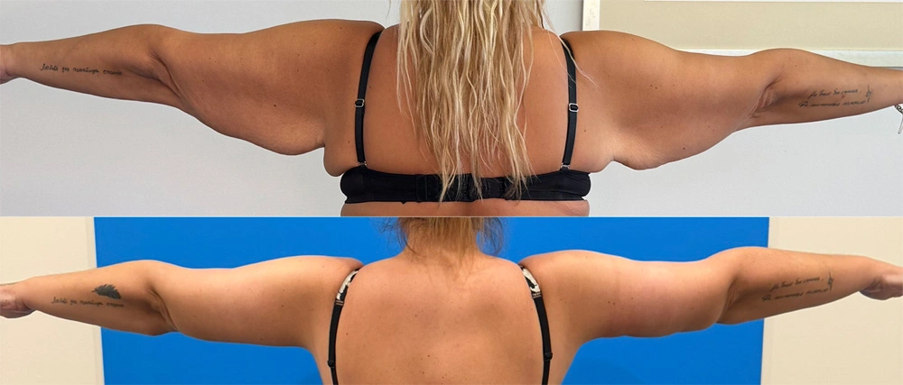 Real Patient Results in New South Wales, Australia Performed by Dr. Anthony Barker